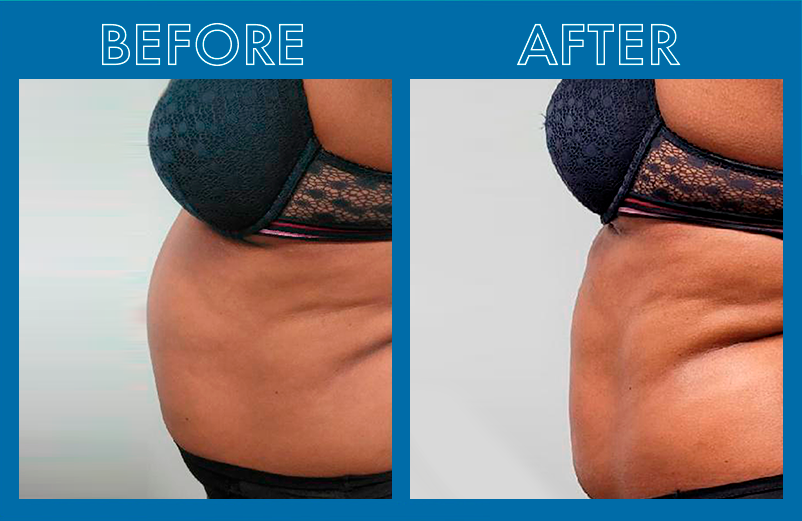 before_after-VOSSMAN-2_1_0a77cf35-aeeb-4b44-9dc8-4c564121672c.png